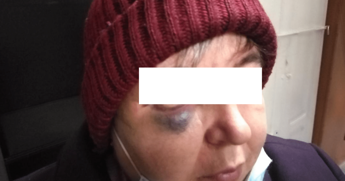 TurdaNews - Telenovelă la Turda: Femeie bătută în plină stradă de soț!  Bărbatul și-a găsit o amantă cu 15 ani mai tânără ca el!